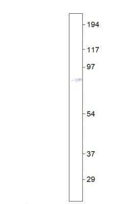 Immunohistochemistry-Paraffin: Bestrophin 3 Antibody [NBP3-12276]