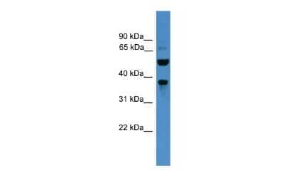 Western Blot: Bestrophin 3 Antibody [NBP2-87071]