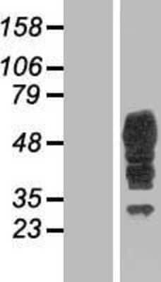 Western Blot: Bestrophin 3 Overexpression Lysate [NBP2-05368]