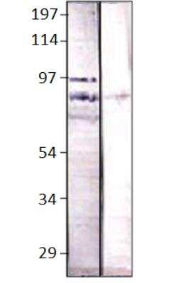 Western Blot: Bestrophin 4 Antibody [NBP3-12382]