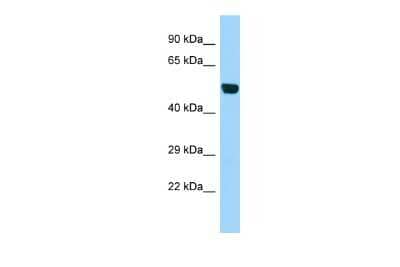 Western Blot: Beta-1,3-N-Acetylglucosaminyltransferase 1/B3GNT1 Antibody [NBP3-10595]