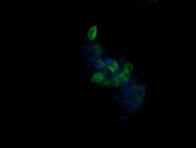 Immunocytochemistry/ Immunofluorescence: Beta-1,3-N-Acetylglucosaminyltransferase 2/B3GNT2 Antibody (OTI3A9) [NBP2-45527]