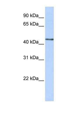 Western Blot: Beta-1,3-N-Acetylglucosaminyltransferase 4/B3GNT4 Antibody [NBP1-55107]