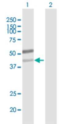 Western Blot: Beta-1,3-N-Acetylglucosaminyltransferase 6/B3GNT6 Antibody [H00192134-B01P]