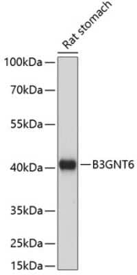 Western Blot: Beta-1,3-N-Acetylglucosaminyltransferase 6/B3GNT6 AntibodyAzide and BSA Free [NBP2-92200]