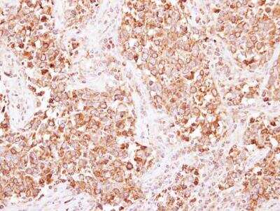 Immunohistochemistry-Paraffin: Beta 2 Adaptin Antibody [NBP2-15563]