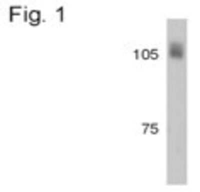 Western Blot: Beta 2 Adaptin Antibody [NB100-74371]