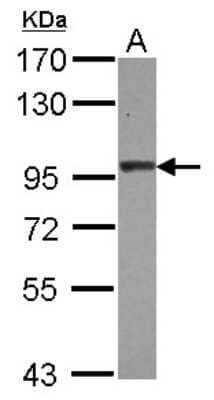 Western Blot: Beta 2 Adaptin Antibody [NBP2-15563]