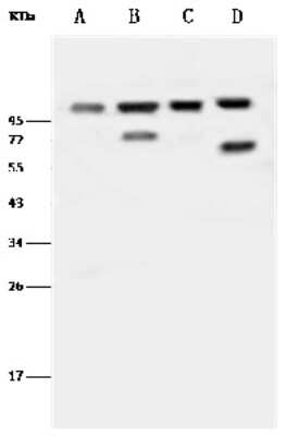 Western Blot: Beta 2 Adaptin Antibody [NBP2-99455]