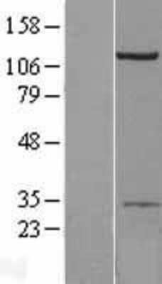 Western Blot: Beta 2 Adaptin Overexpression Lysate [NBL1-07579]