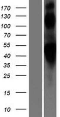 Western Blot: beta-2 Adrenergic R/ADRB2 Overexpression Lysate [NBP2-11173]