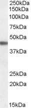 Western Blot: beta-3 Adrenergic R/ADRB3 Antibody [NB100-93369]