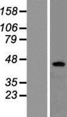 Western Blot: beta-3 Adrenergic R/ADRB3 Overexpression Lysate [NBP2-11174]