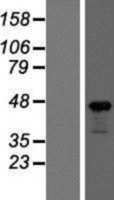 Western Blot: beta-Actin Overexpression Lysate [NBP2-10939]