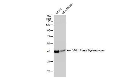Western Blot: Beta Dystroglycan Antibody (GT2812) [NBP3-13644]