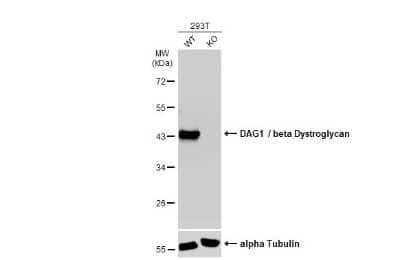 Western Blot: Beta Dystroglycan Antibody (GT2812) [NBP3-13644]