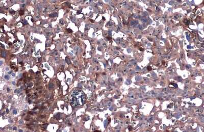 Immunohistochemistry-Paraffin: Beta Dystroglycan Antibody (GT835) [NBP3-13643]