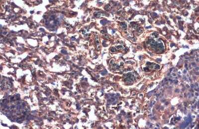 Immunohistochemistry-Paraffin: Beta Dystroglycan Antibody (GT9112) [NBP3-13642]
