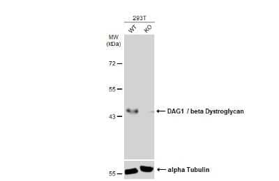 Western Blot: Beta Dystroglycan Antibody (GT9112) [NBP3-13642]