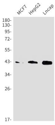 Western Blot: Beta Dystroglycan Antibody (S05-5B5) [NBP3-19985]