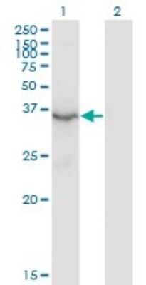 Western Blot: Beta Hydroxysteroid Dehydrogenase Antibody (1E8) [H00003284-M02]