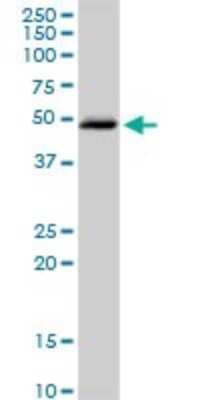 Western Blot: Beta Hydroxysteroid Dehydrogenase Antibody [H00003284-D01P]