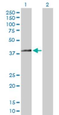 Western Blot: Beta Hydroxysteroid Dehydrogenase Antibody [H00003284-D01P]