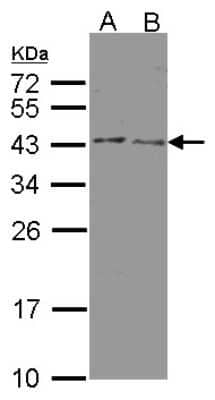 Western Blot: Beta Hydroxysteroid Dehydrogenase Antibody [NBP1-32353]