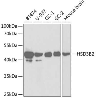 Western Blot: Beta Hydroxysteroid Dehydrogenase AntibodyAzide and BSA Free [NBP2-92640]