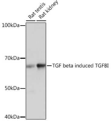 Western Blot: Beta Ig-h3/TGFBI Antibody (7Q5O9) [NBP3-15994]