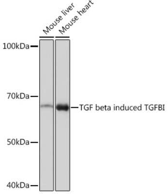 Western Blot: Beta Ig-h3/TGFBI Antibody (7Q5O9) [NBP3-15994]