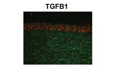 Immunohistochemistry-Paraffin: Beta Ig-h3/TGFBI Antibody [NBP1-60049]