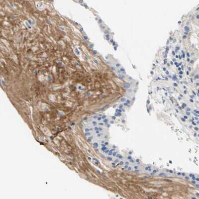 Immunohistochemistry-Paraffin: Beta Ig-h3/TGFBI Antibody [NBP1-88606]