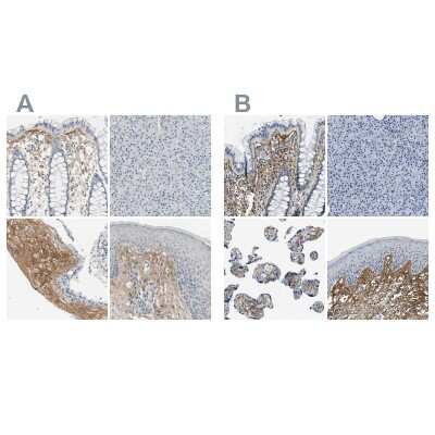 Immunohistochemistry-Paraffin: Beta Ig-h3/TGFBI Antibody [NBP1-88606]