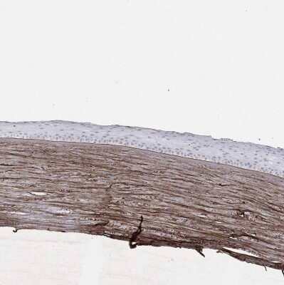 Immunohistochemistry-Paraffin: Beta Ig-h3/TGFBI Antibody [NBP1-88606]