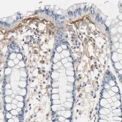 Immunohistochemistry-Paraffin: Beta Ig-h3/TGFBI Antibody [NBP1-88606]
