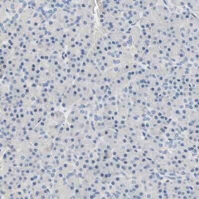 Immunohistochemistry-Paraffin: Beta Ig-h3/TGFBI Antibody [NBP1-88606]