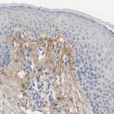 Immunohistochemistry-Paraffin: Beta Ig-h3/TGFBI Antibody [NBP1-88606]