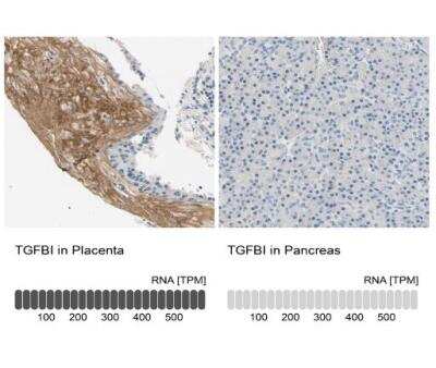 Immunohistochemistry-Paraffin: Beta Ig-h3/TGFBI Antibody [NBP1-88606]