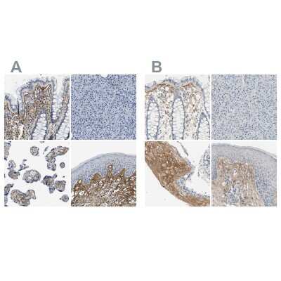 Immunohistochemistry-Paraffin: Beta Ig-h3/TGFBI Antibody [NBP2-48534]