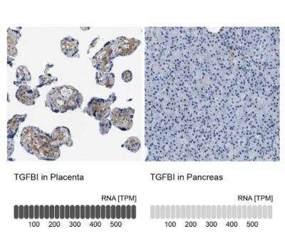 Immunohistochemistry-Paraffin: Beta Ig-h3/TGFBI Antibody [NBP2-48534]