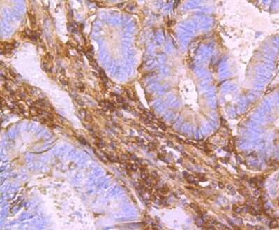 Immunohistochemistry-Paraffin: Beta Ig-h3/TGFBI Antibody (JM24-53) [NBP2-67186]