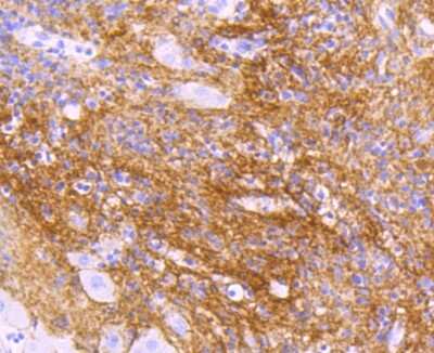 Immunohistochemistry-Paraffin: Beta Ig-h3/TGFBI Antibody (JM24-53) [NBP2-67186]
