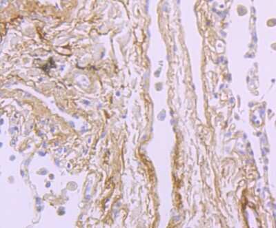 Immunohistochemistry-Paraffin: Beta Ig-h3/TGFBI Antibody (JM24-53) [NBP2-67186]