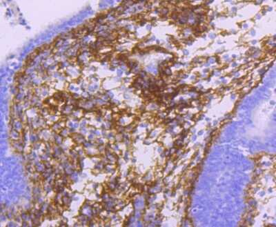 Immunohistochemistry-Paraffin: Beta Ig-h3/TGFBI Antibody (JM24-53) [NBP2-67186]