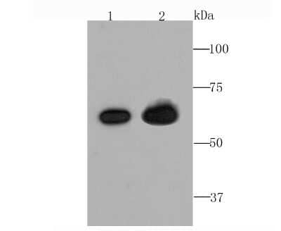 Western Blot: Beta Ig-h3/TGFBI Antibody (JM24-53) [NBP2-67186]