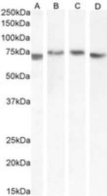 Western Blot: Beta Ig-h3/TGFBI Antibody [NBP1-47215]