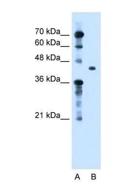 Western Blot: Beta Ig-h3/TGFBI Antibody [NBP1-60049]