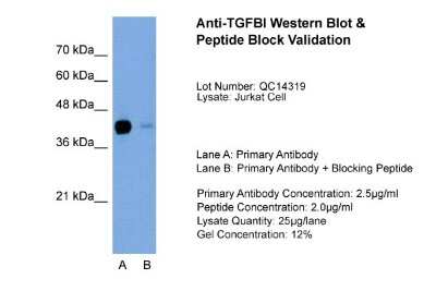Western Blot: Beta Ig-h3/TGFBI Antibody [NBP1-60049]