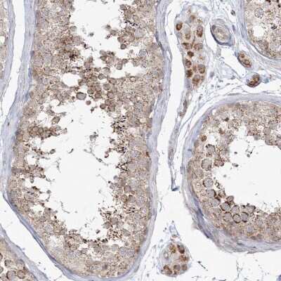 Immunohistochemistry-Paraffin: LACTB Antibody [NBP1-91700]